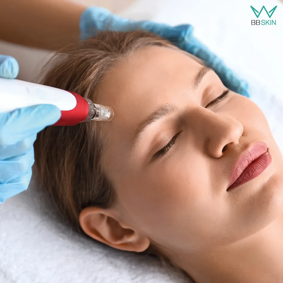 Julia Herger Leistung Gesichtbehandlung Microneedling BB Skin